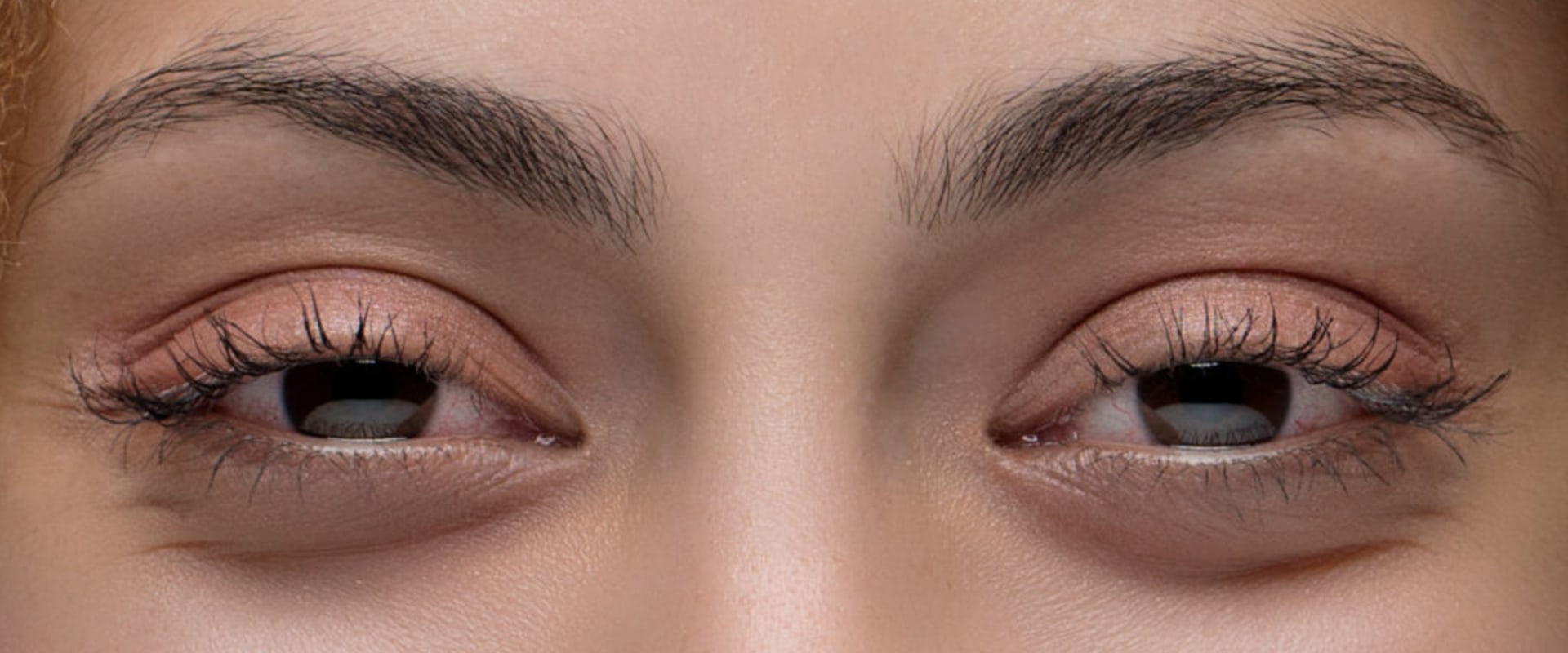 Do you not feel pain when high?